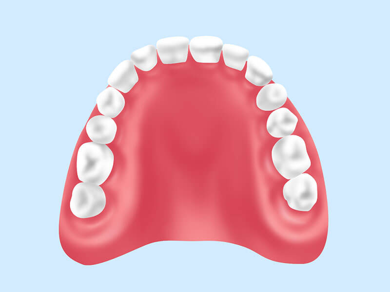 レジン床義歯（保険診療）