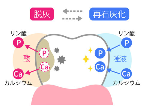 知っていました？むし歯のメカニズム①〜溶けると治る〜